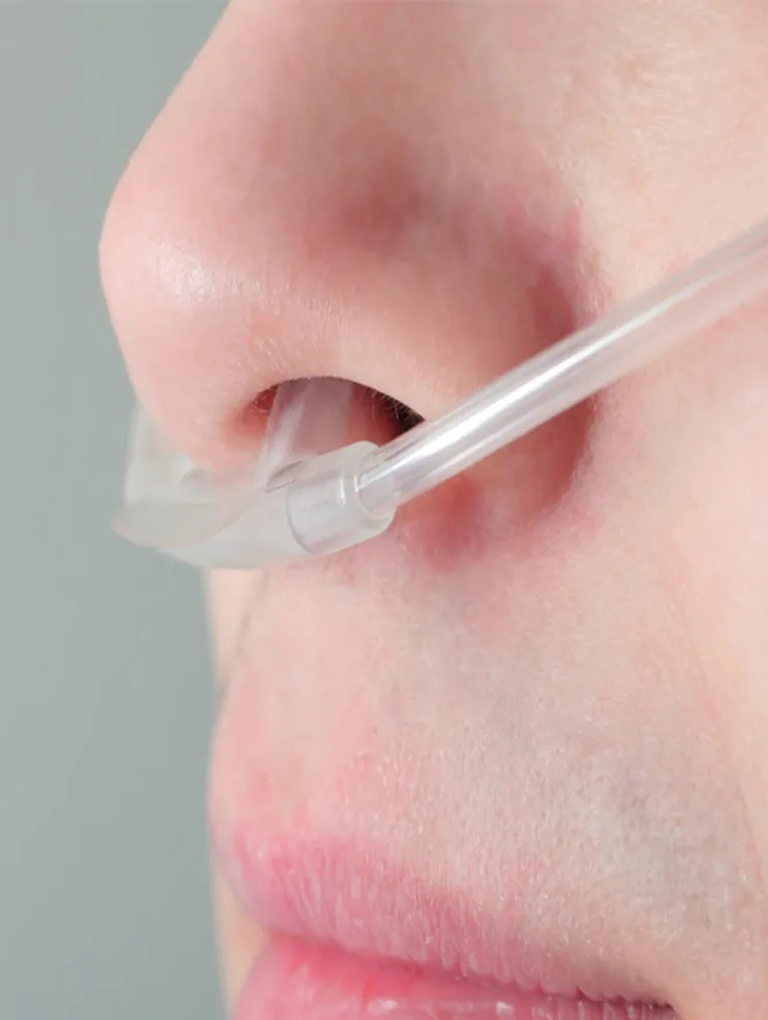 Cateter Nasal para Oxigênio Tipo Óculos Adulto 